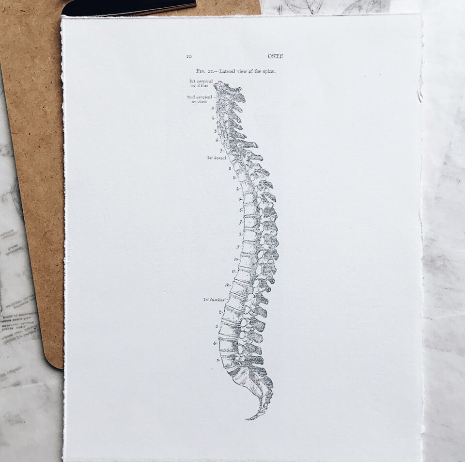 Lumbar Arthritis, Arthritis in the Lower Back