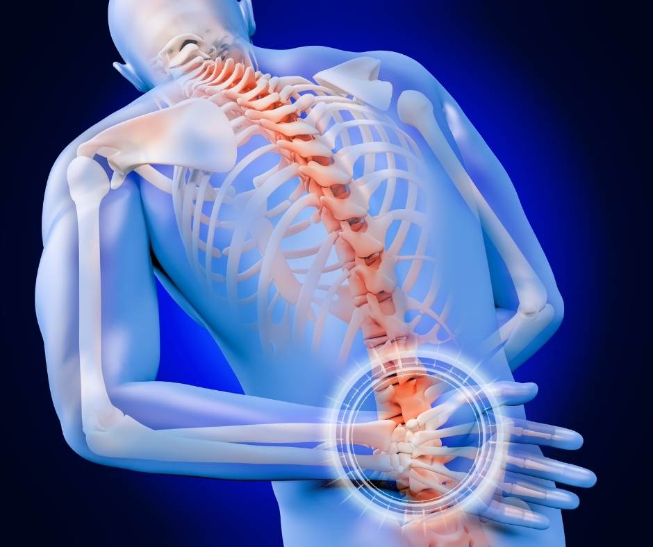 A skeleton with pain in back.