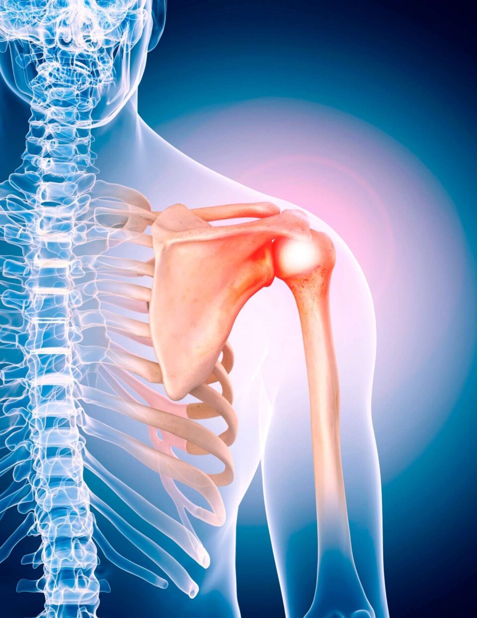 An image of a person with a shoulder injury.