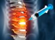 A syringe injects fluid into an inflamed spinal column, highlighting red and orange areas likely representing pain or inflammation form a spinal compression fracture.