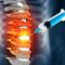 A syringe injects fluid into an inflamed spinal column, highlighting red and orange areas likely representing pain or inflammation form a spinal compression fracture.